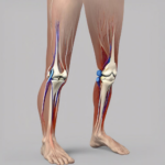Iontophorese Knie: Eine informelle Betrachtung der Anwendung und Wirkmechanismen