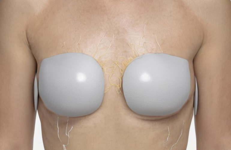 Iontophorese gegen Hyperhidrose: Evidenz, Wirkmechanismen und praktische Tipps für Sie 20 Iontophorese gegen Hyperhidrose: Evidenz, Wirkmechanismen und praktische Tipps für Sie