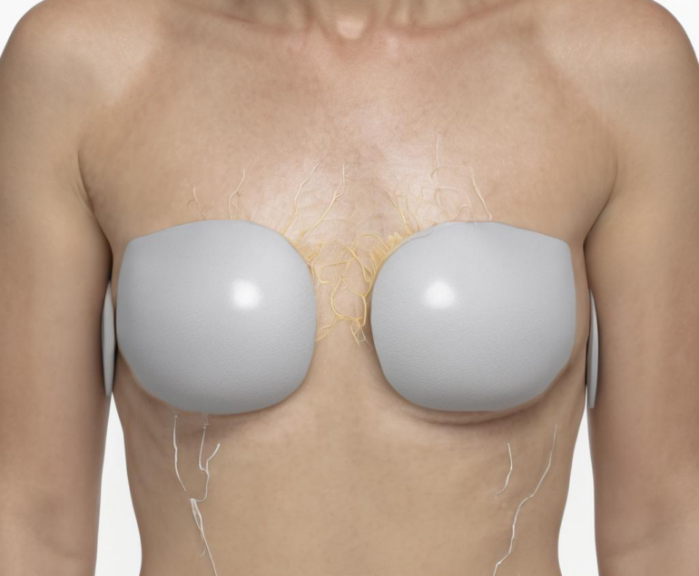 Iontophorese gegen Hyperhidrose: Evidenz, Wirkmechanismen und praktische Tipps für Sie