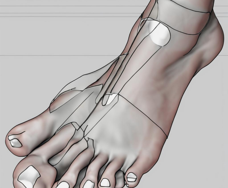 Iontophorese Füße: Ein akademischer, aber lockerer Leitfaden – Was Sie über Wirkmechanismen, Wirksamkeit und Mythen wissen sollten