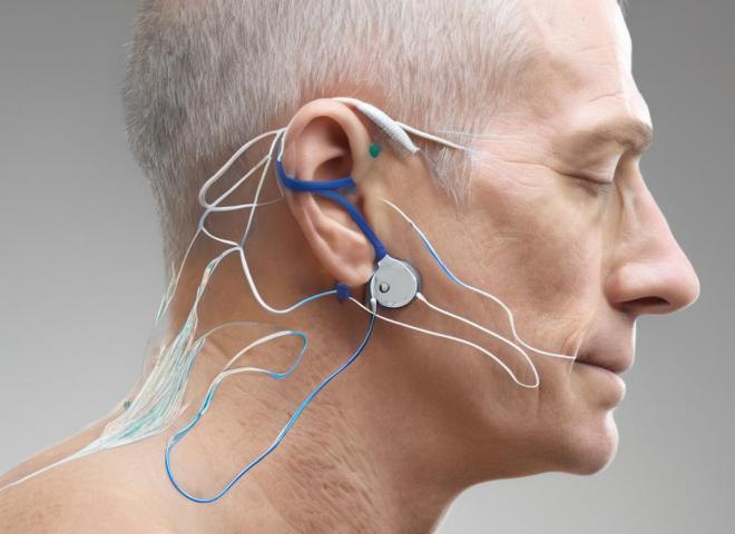 Was Sie zur iontophorese therapie evidenz wissen sollten: Eine akademische, praxisnahe Übersicht