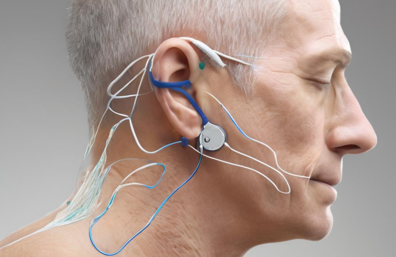 Was Sie zur iontophorese therapie evidenz wissen sollten: Eine akademische, praxisnahe Übersicht