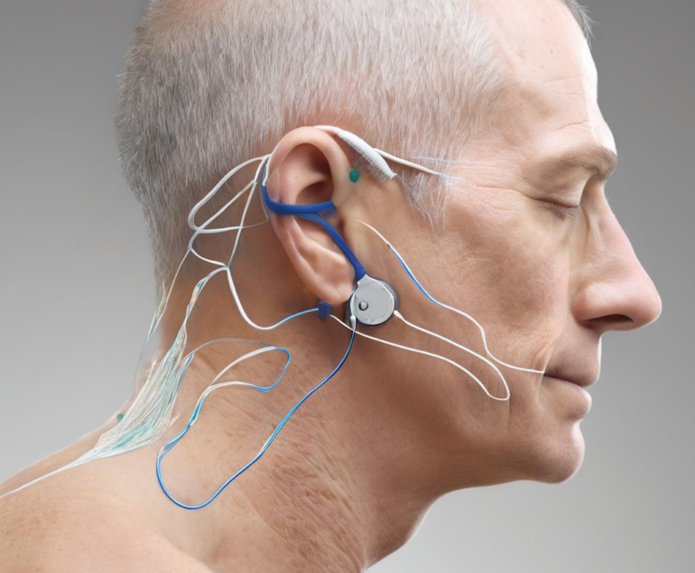 Was Sie zur iontophorese therapie evidenz wissen sollten: Eine akademische, praxisnahe Übersicht