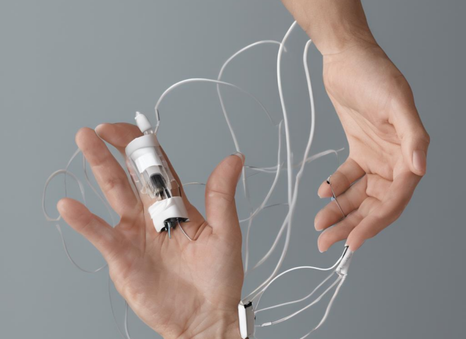 Iontophorese hände erfahrungen: Ein akademisch-informeller, praxisnaher Überblick für Sie 7 Iontophorese hände erfahrungen: Ein akademisch-informeller, praxisnaher Überblick für Sie