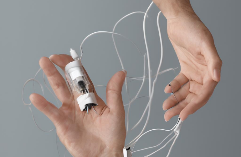 Iontophorese hände erfahrungen: Ein akademisch-informeller, praxisnaher Überblick für Sie 25 Iontophorese hände erfahrungen: Ein akademisch-informeller, praxisnaher Überblick für Sie