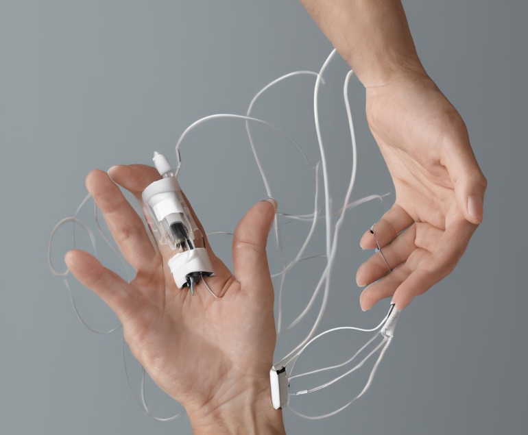 Iontophorese hände erfahrungen: Ein akademisch-informeller, praxisnaher Überblick für Sie