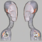 Iontophorese Kostenübernahme: Was Sie über Anspruch, Antrag und Erstattung wissen sollten
