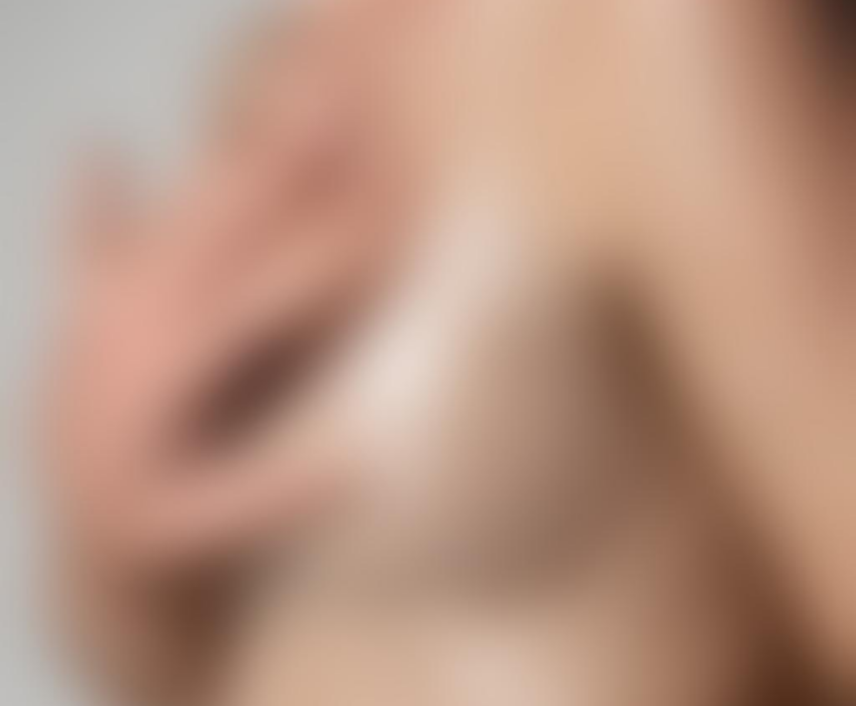 Hyperhidrose-Behandlung: Mythen, Befunde und was Sie wirklich wissen sollten 13 Hyperhidrose-Behandlung: Mythen, Befunde und was Sie wirklich wissen sollten