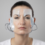 Iontophorese-Behandlungsmethode: Was Sie aus Forschung und Praxis wissen sollten