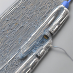 Elektroden für Iontophorese: Was Sie über Typen, Anwendung und aktuelle Forschung wissen sollten