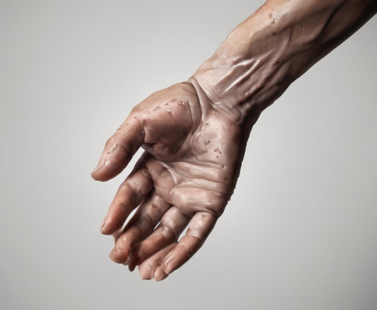 Was tun gegen schwitzige Hände? Evidenzbasierte, praxisnahe Strategien für Sie