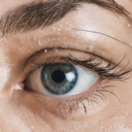 Generate high resolution image iontophoresis 34587