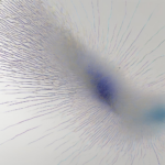 Iontophorese kritik im Fokus: Was Sie für Forschung und Praxis wissen sollten