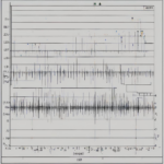 Was Sie über iontophorese therapieintervalle wissen sollten: Ein informell-akademischer Leitfaden