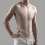 Dauerhafte Hilfe bei Hyperhidrose: Wie Sie evidenzbasierte Behandlungsstrategien verstehen und anwenden