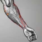 Iontophorese bei Epicondylitis: Was Sie wissenschaftlich fundiert und praxisnah wissen sollten