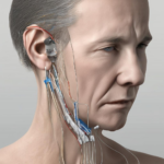 Iontophorese tinnitus: Was Sie wissen sollten – wissenschaftlich fundiert und verständlich
