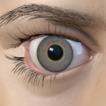 Was Sie über iontophorese augen wissen sollten: Eine akademisch-informelle Einführung